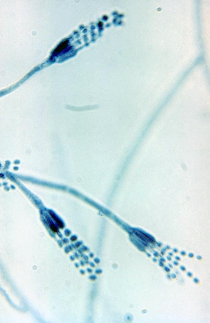 Photomicrograph of Penicillium conidiophores (CDC Public Health Image Library, public domain) — the brush-like spore-bearing structures characteristic of the Penicillium genus.